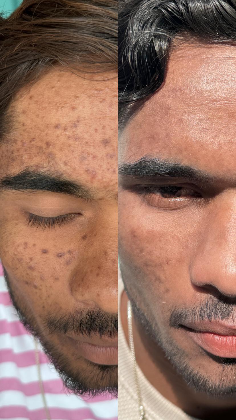 Personalized Skincare Consultation
