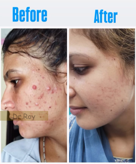 Skin Brightening Results